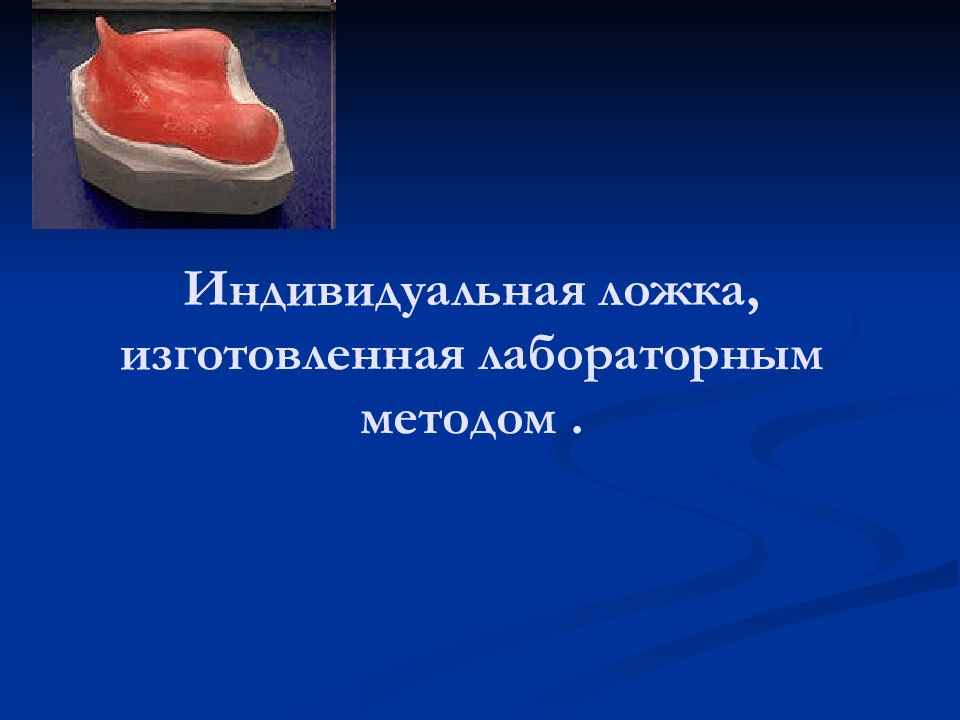 Индивидуальные ложки в ортопедической стоматологии презентация