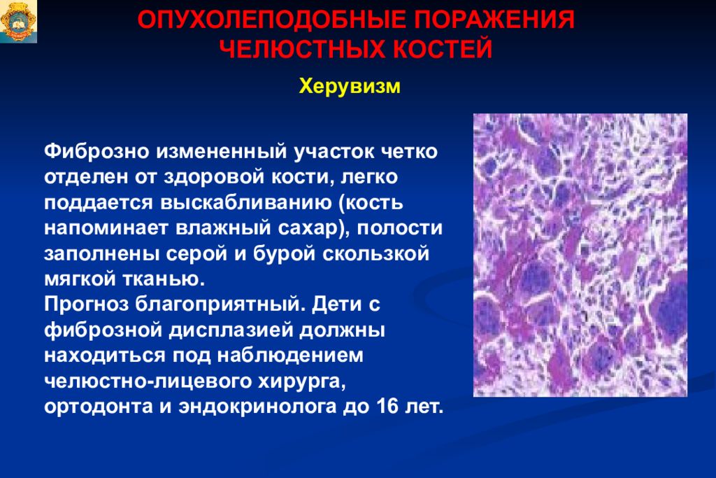 Опухоли опухолеподобные поражения и кисты кожи лица презентация