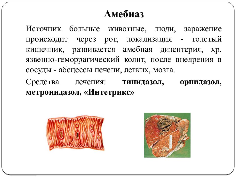 Стул при амебиазе