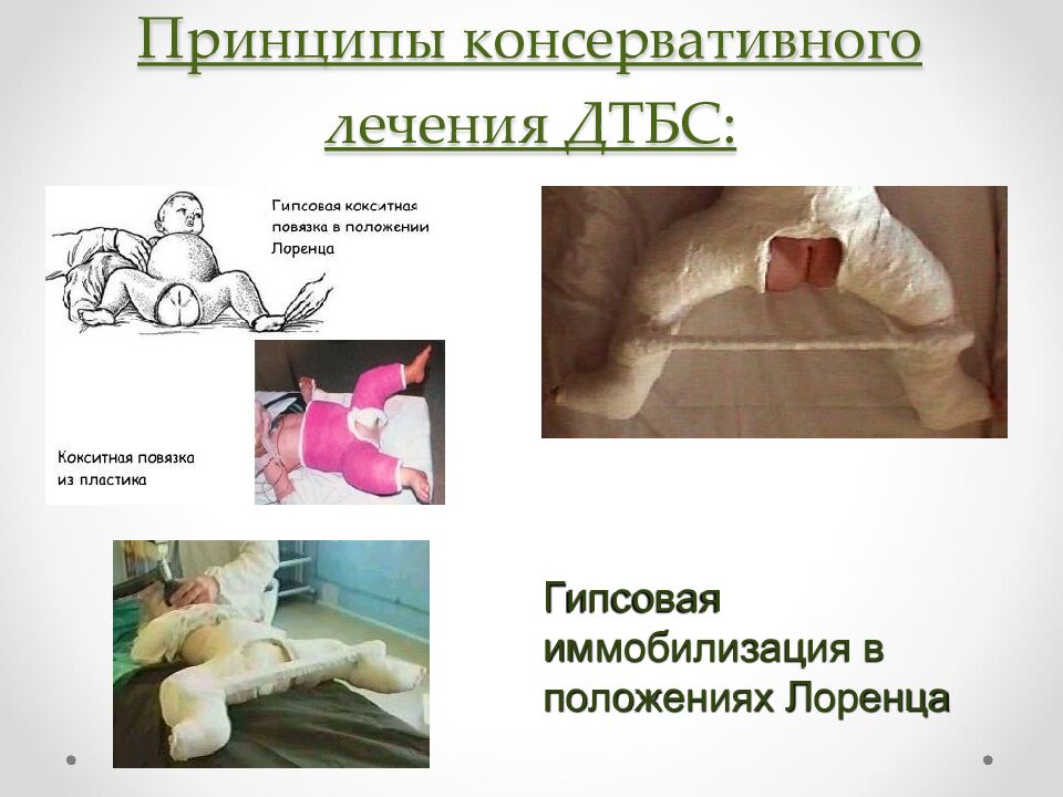 Принципы консервативного лечения ДТБС: