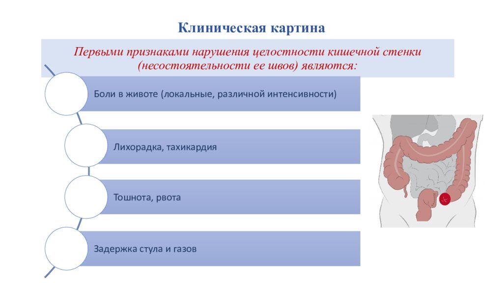 Боль в прямой кишке у женщин после стула причины и лечение