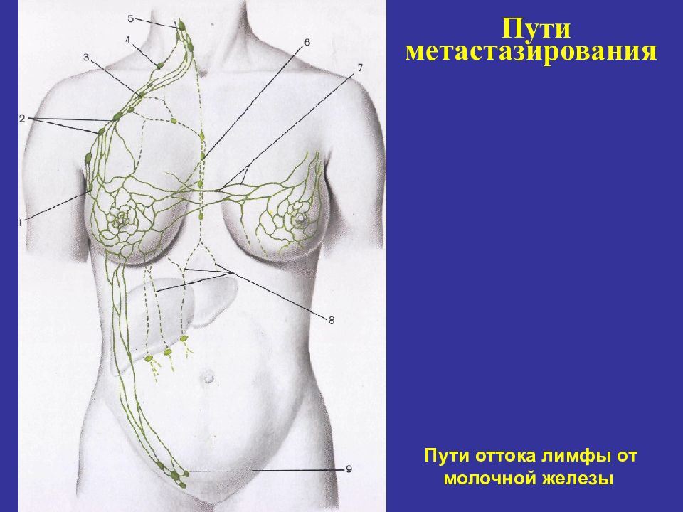 Рак молочной железы презентация на английском