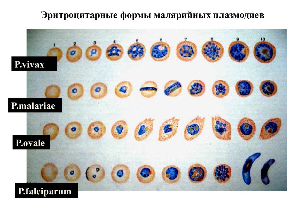 Малярийный плазмодий царство. Формы малярийного плазмодия. Юный трофозоит малярийного плазмодия. Сравнительная морфология малярийных плазмодиев. Виды малярийных плазмодиев.