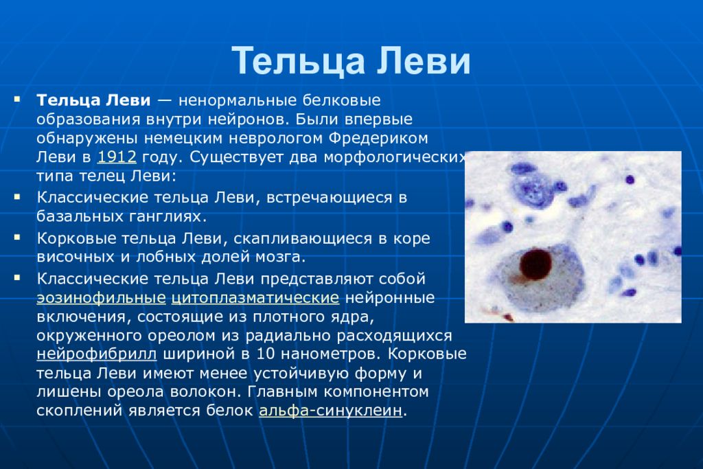 Деменции с тельцами. Тельца Леви. Деменция тельца Леви. Деменция с тельцами Леви гистология. Тельца Леви при болезни Паркинсона.