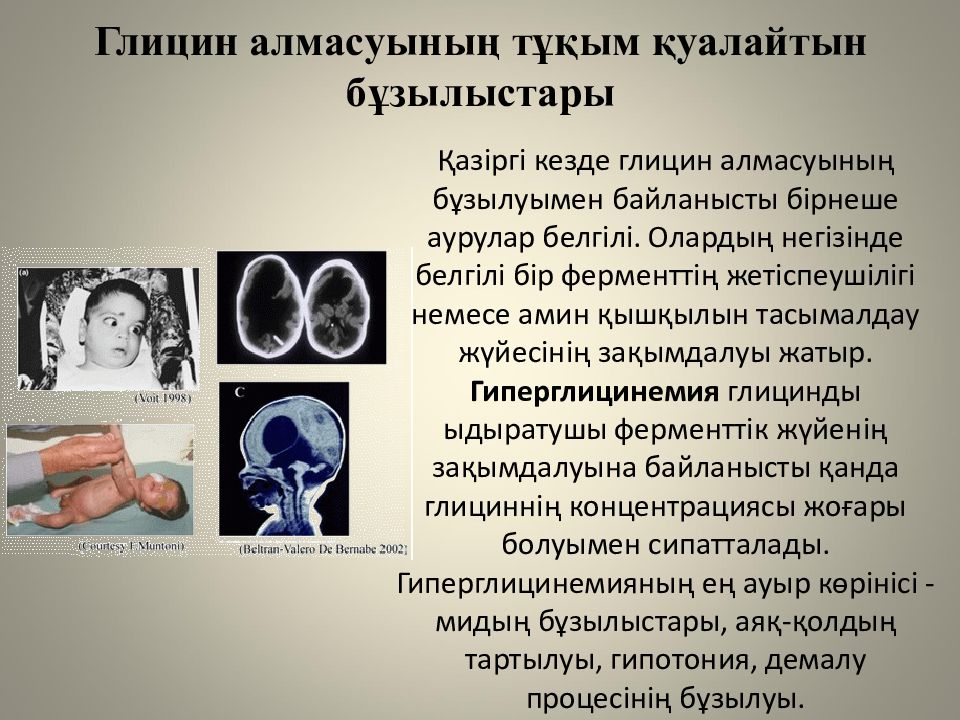 Жеке аминқышқылдардың алмасуы және оның бұзылуының биохимиялық негіздері Глицин алмасуының тұқым қуалайтын бұзылыстары