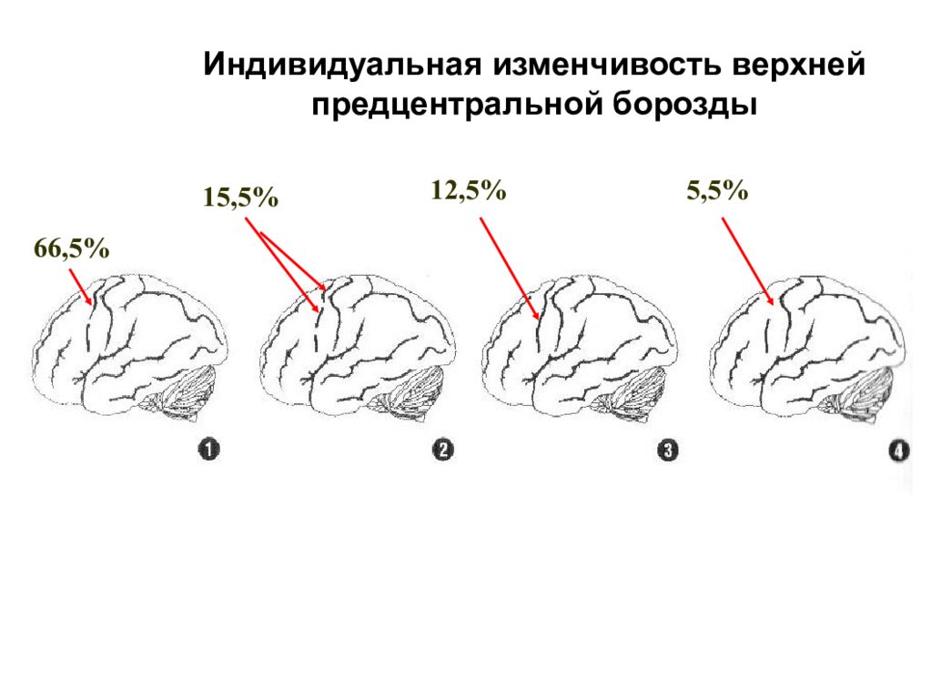 Индивидуальная изменчивость. Индивидуальная изменчивость головного мозга. Возрастная изменчивость верхней конечности. 5.Предцентральная борозда. Индивидуальная изменчивость верхней челюсти.