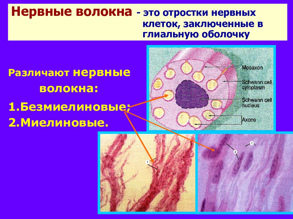 Нервные волокна кожи. Безмиелиновые нервные волокна гистология. Безмиелиновое нервное волокно гистология. Безмякотные нервные волокна препарат гистология. Безмиелиновые волокна препарат.