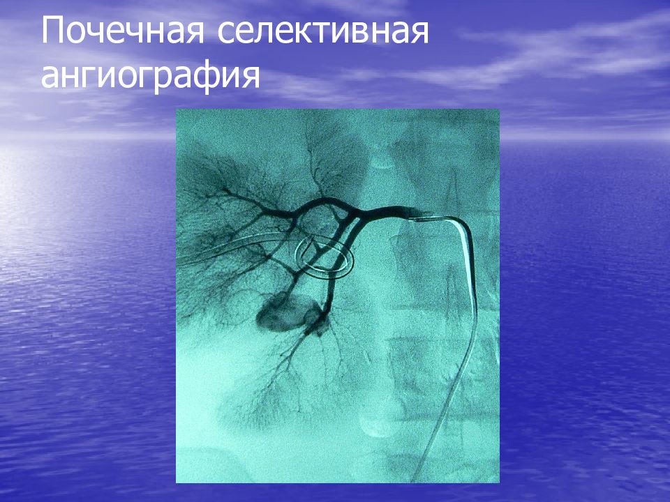 Травмы органов мочевыделительной системы презентация