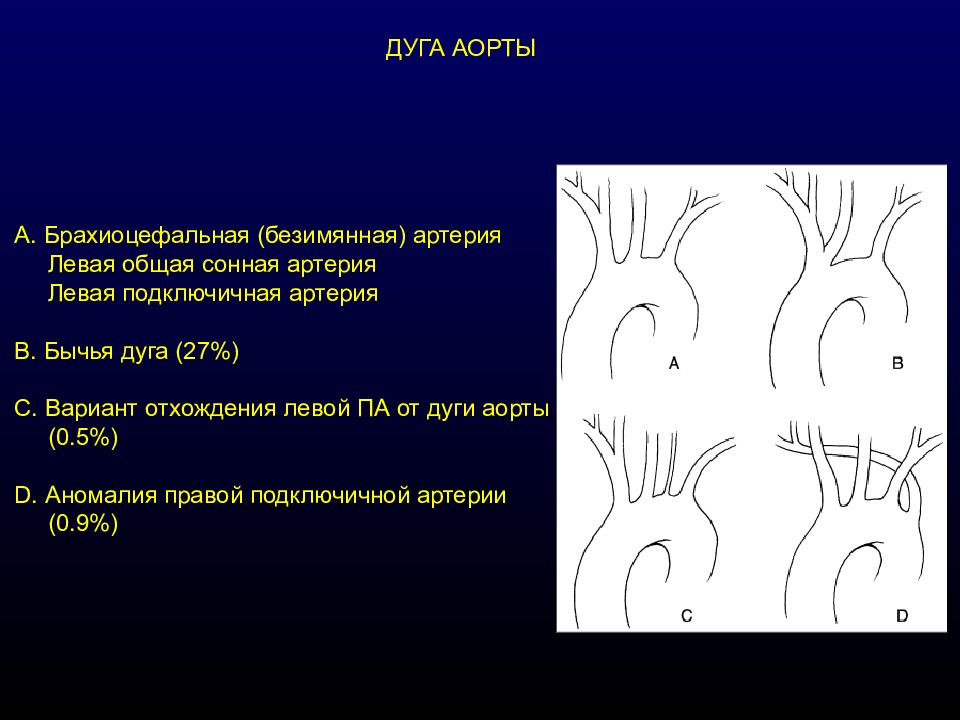 Правая аорта. Аномалии отхождения ветвей дуги аорты. Типы дуги аорты анатомические. Анатомические варианты ветвей дуги аорты. Вариантная анатомия дуги аорты.