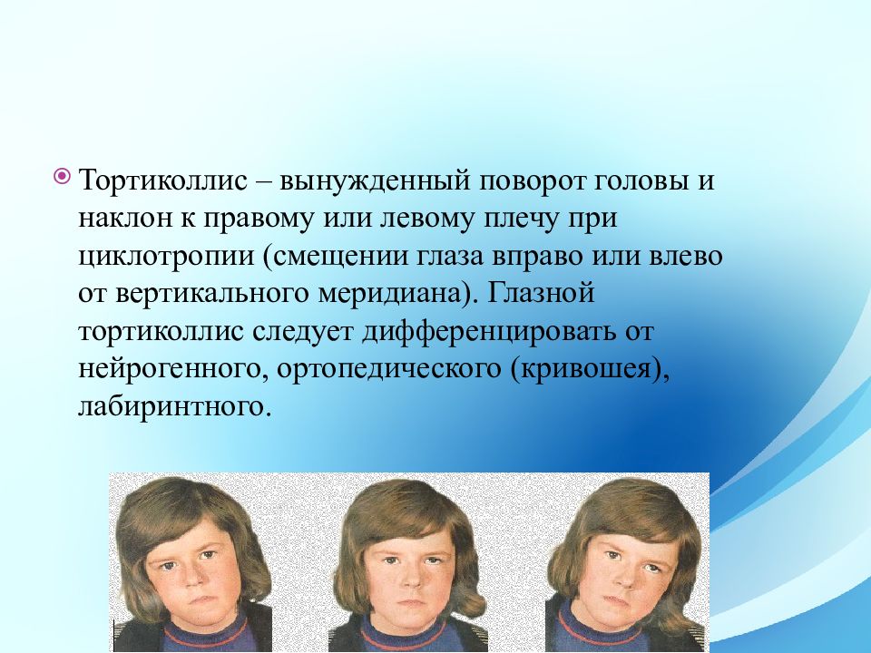 Патология глазодвигательного аппарата презентация