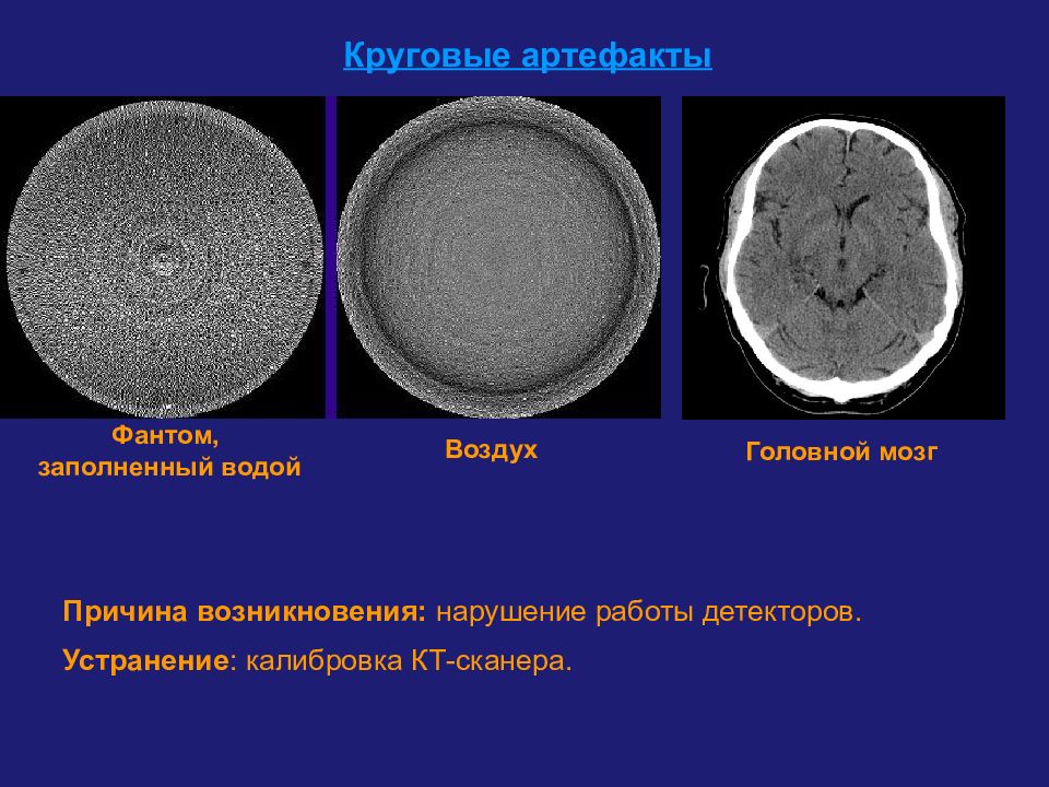 Артефакты кт изображений