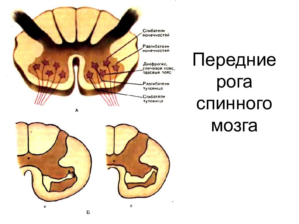 Передние рога спинного мозга. Мотонейронов передних Рогов спинного мозга. Ядра задних боковых и передних Рогов спинного мозга. Поражение переднего рога спинного мозга. Синдром поражения передних Рогов спинного мозга.