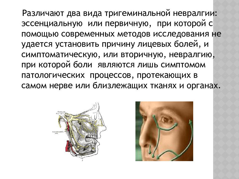 Тройничный нерв воспаление. Невралгия тройничного нерва презентация. Неврит и невралгия тройничного нерва. Сестринский процесс при неврите тройничного нерва. Для неврита тройничного нерва характерны.