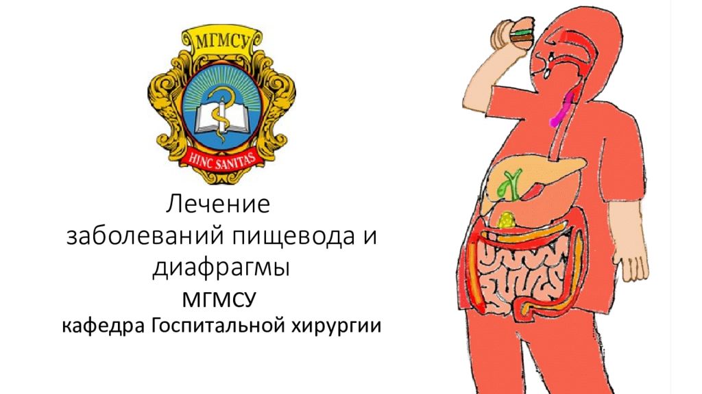 Лечение заболеваний пищевода и диафрагмы