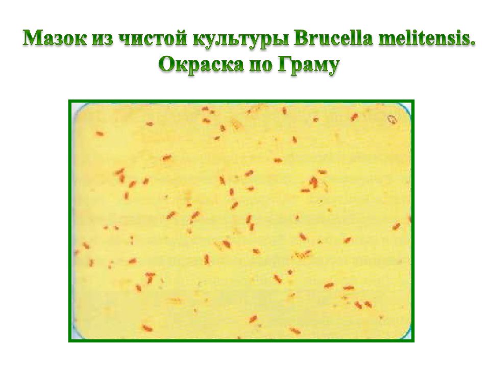 Мальтийская лихорадка. Бруцеллы окраска по грамму. Brucella Melitensis окраска по Граму. Brucella Melitensis морфология. Бруцелла окраска по Граму.