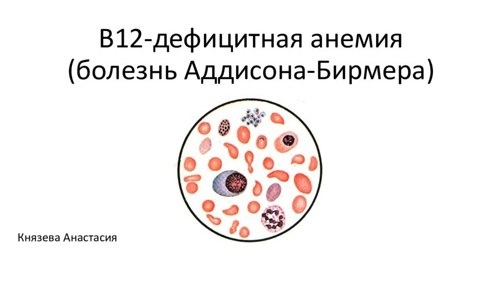 Картина крови при болезни аддисона бирмера в стадию рецидива