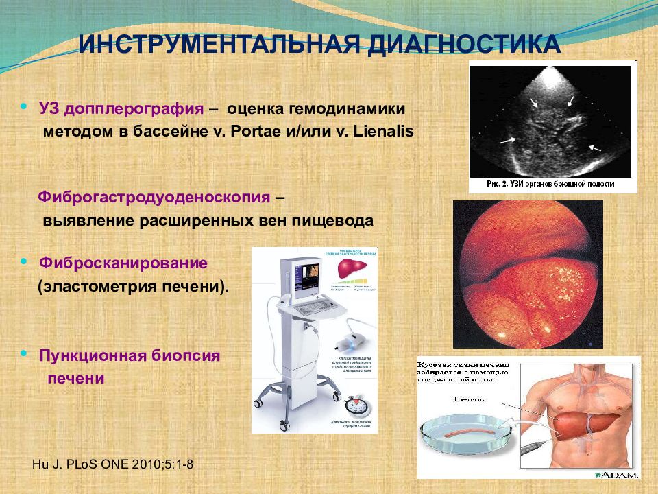 Острые вирусные гепатиты в ультразвуковом изображении сопровождаются