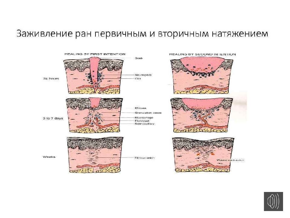 Через сколько заживает рана