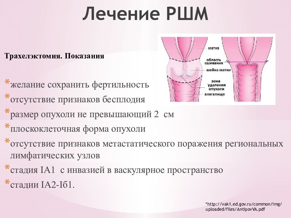 Рак матки симптомы и признаки на ранних