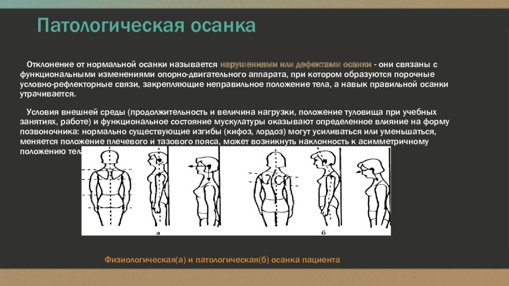 Определенное положение тела. Патологическая осанка. Профилактика патологической осанки. Виды патологической осанки. Что такое физиологическая и патологическая осанка?.