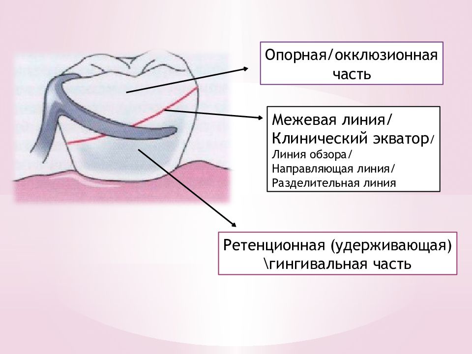 Части линии. Клинический Экватор. Анатомический и клинический Экватор зуба. Ретенционная зона кламмера. Ретенционная часть кламмера располагается в зоне.