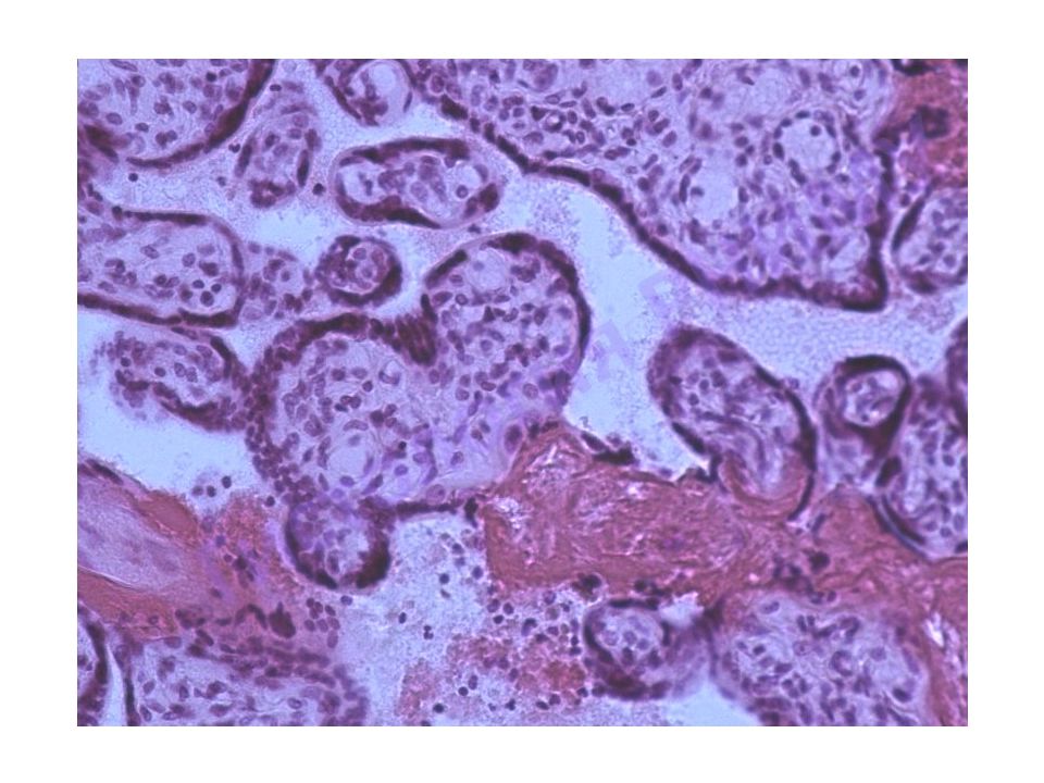 Плацента гистология. Плодная часть плаценты препарат. Гемохориальная плацента гистология. Плодная часть плаценты гистология. Трофобласт плаценты гистология.