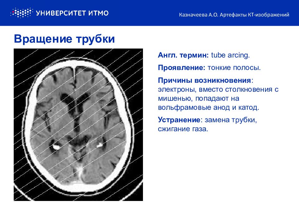 Артефакты кт изображений