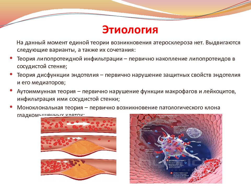 Этиология картинки для презентации