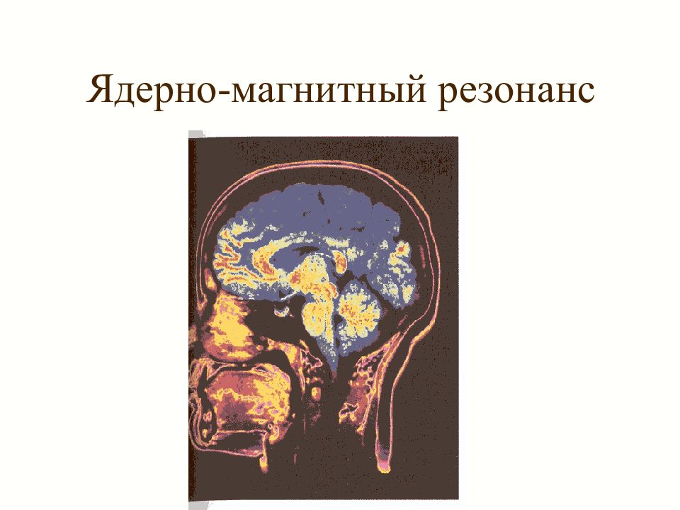 Магнитный резонанс. Метод ядерного магнитного резонанса. Ядерная магнитная резонансная интроскопия. Электромагнитный резонанс. Ядерный магнитный резонанс физика.