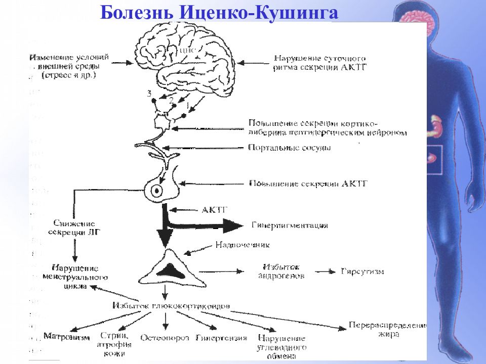 Синдром и болезнь иценко кушинга презентация