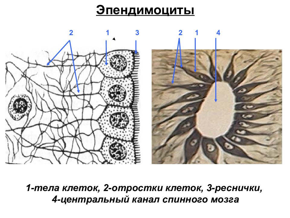 На схеме представлены клетки нейроглии первый тип клетки цилиндрической формы с ресничками