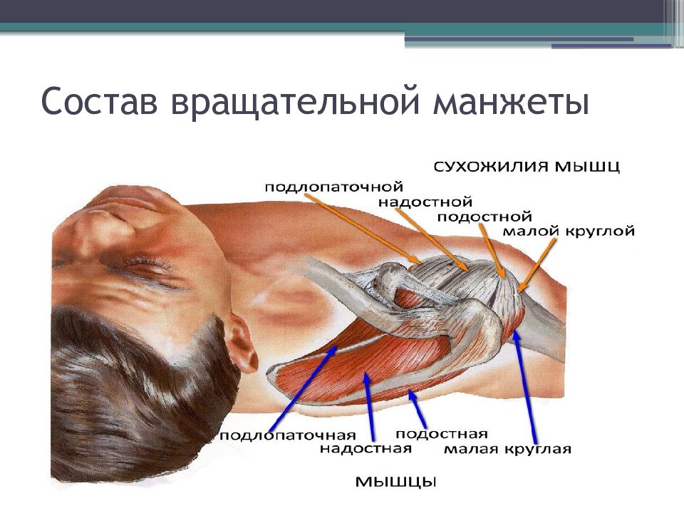 Разрыв манжеты плечевого. Вращательная манжета плеча мышцы. Травма сухожилия надостной мышцы. Разрыв вращательной (ротаторной) манжеты плеча. Ротаторная манжета мышцы.