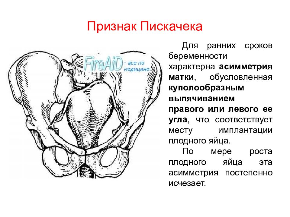 Диагностика ранних сроков беременности презентация