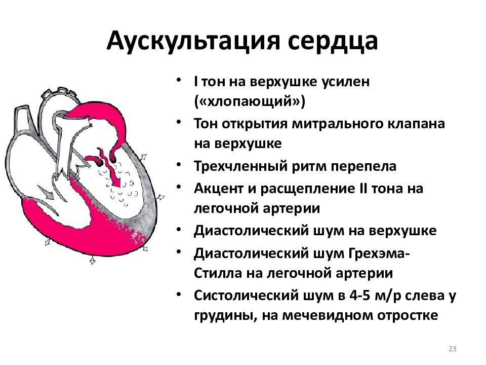 Аускультативная картина при митральном стенозе сердца включает на верхушке