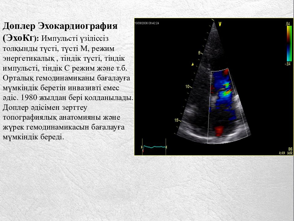 Доплер это. Доплер-эхокардиография. Допплер эхокардиография. Эхо кг допплер. Допплер режим ЭХОКГ.