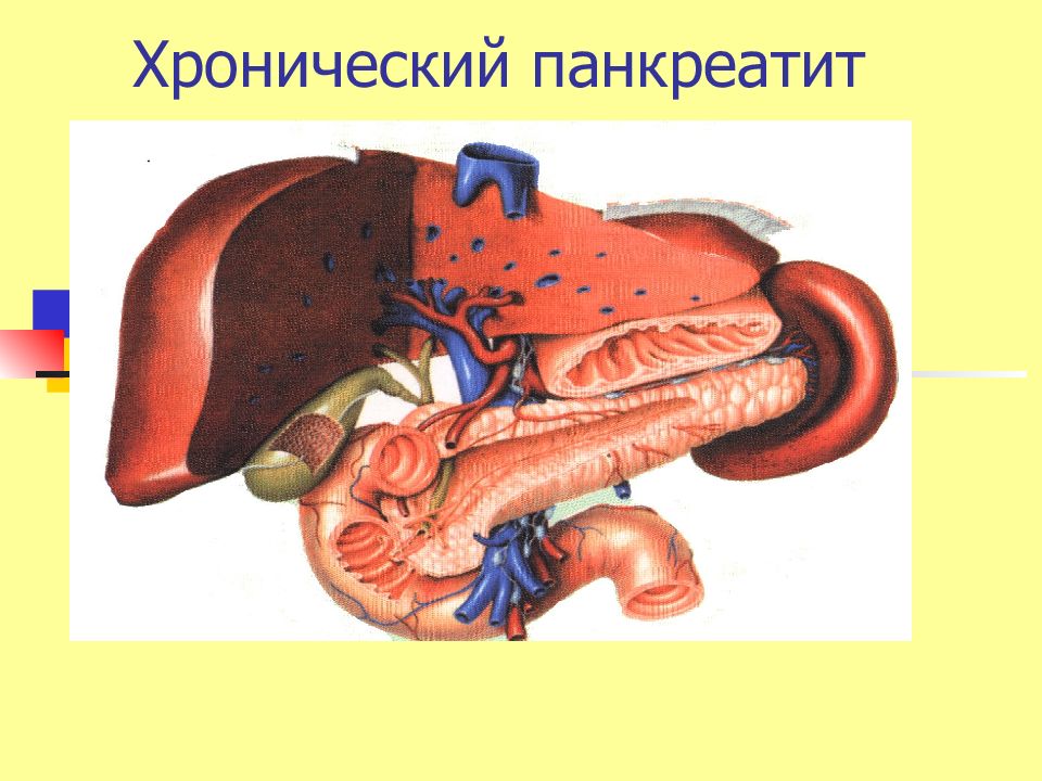 Презентация на тему хронический панкреатит