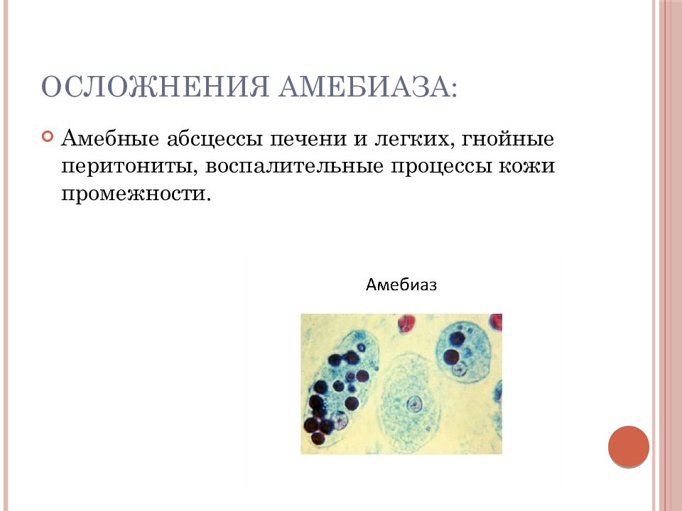 Амебиаз презентация казакша