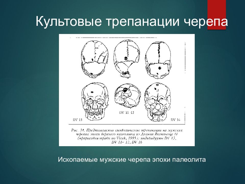 Онтогенез речи презентация