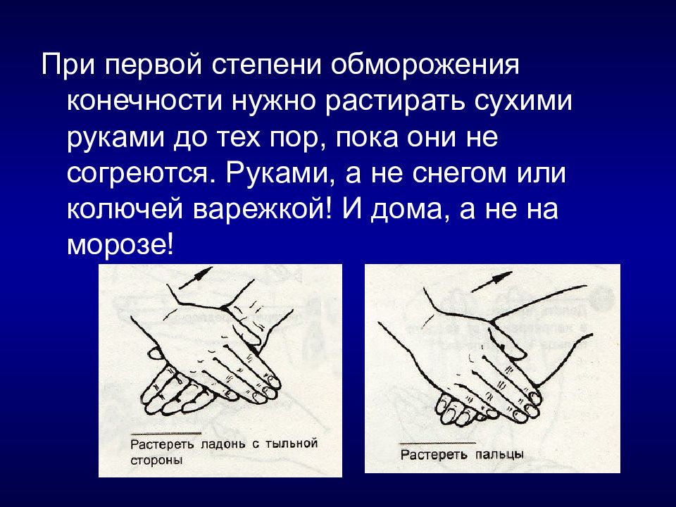 При обморожении конечностей необходимо. В случае отморожения конечности необходимо. Руки перетирает.