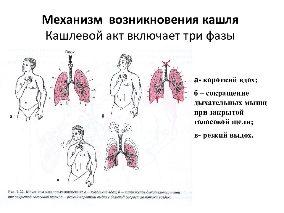 Заболевания с кашлем. Механизм кашля. Механизм развития кашля. Кашель физиология. Механизм появления кашля.