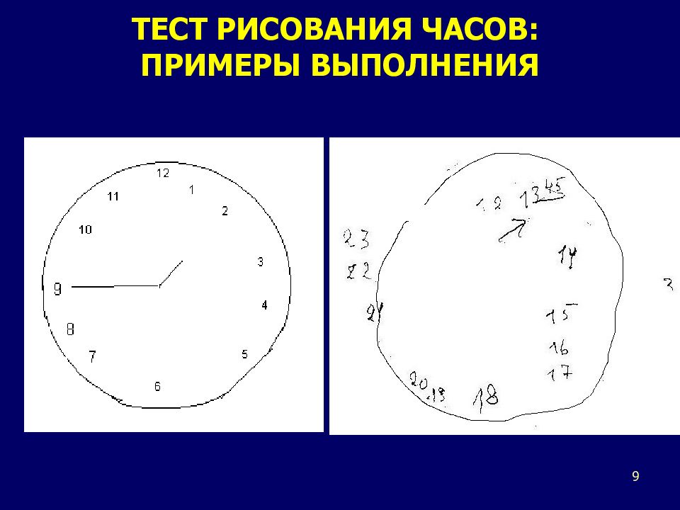 Тесты от деменции в картинках