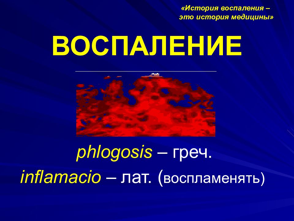 Воспаление картинки для презентации