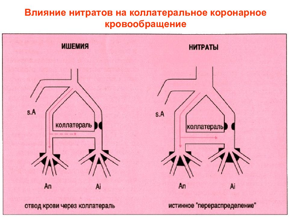 Расширение коронарных артерий нитроглицерин. Влияние нитратов на коронарный кровоток. Действие нитратов на сосуды. Перераспределение кровотока. Нитраты влияние на гемодинамику.