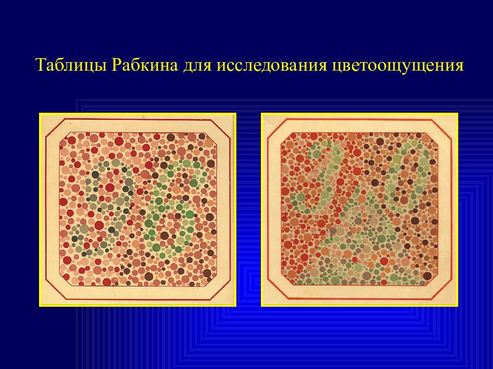 Таблица рабкина с ответами. Таблица для исследования цветоощущения Рабкина. Полихроматические таблицы для исследования цветоощущения. Книга для исследования цветоощущения. Полихроматические таблицы е.б. Рабкина.