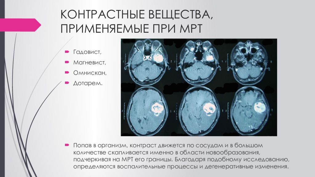 Мрт методика получения изображения