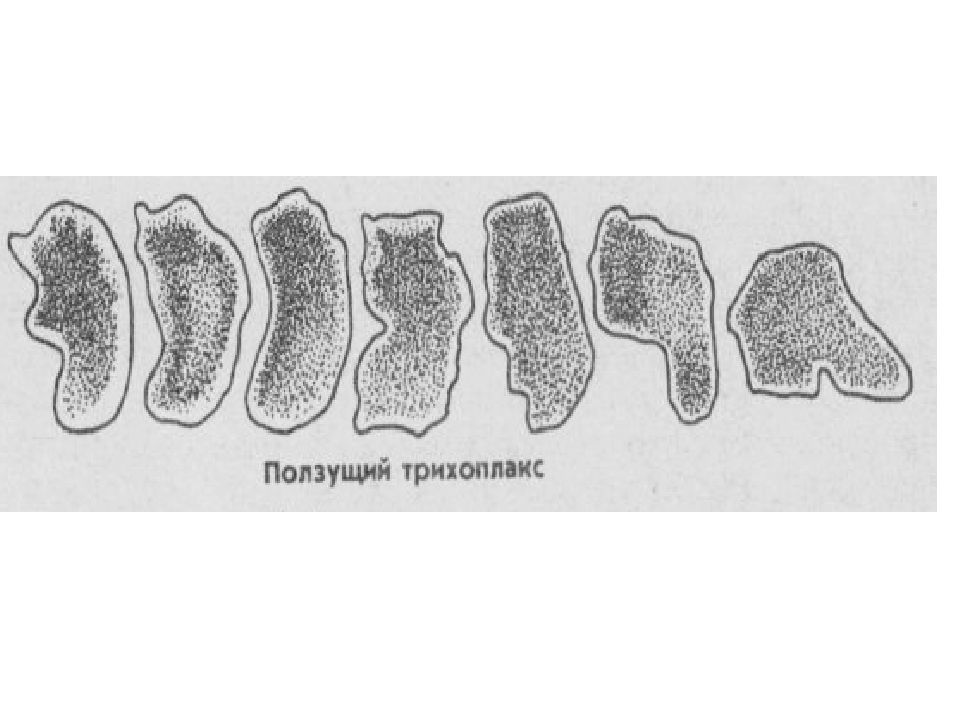 Трихоплакс для волос. Трихоплакс препарат. Трихоплакс рисунок. Trichoplax боковой срез.