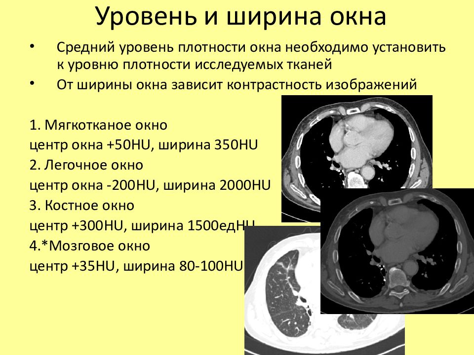 Шкала хаунсфилда презентация