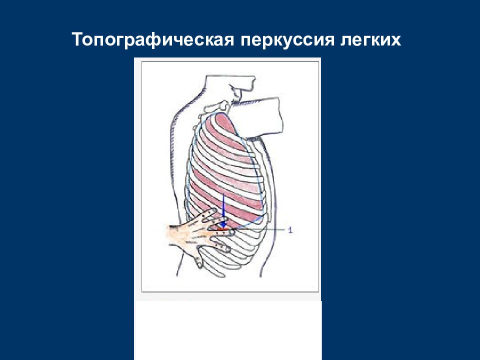 Топографическая перкуссия. Топографическая перкуссия легких алгоритм. Топографическая перкуссия легких КРС.