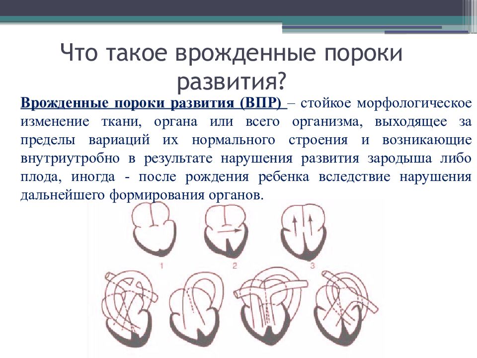 Врожденные пороки развития нервной системы презентация