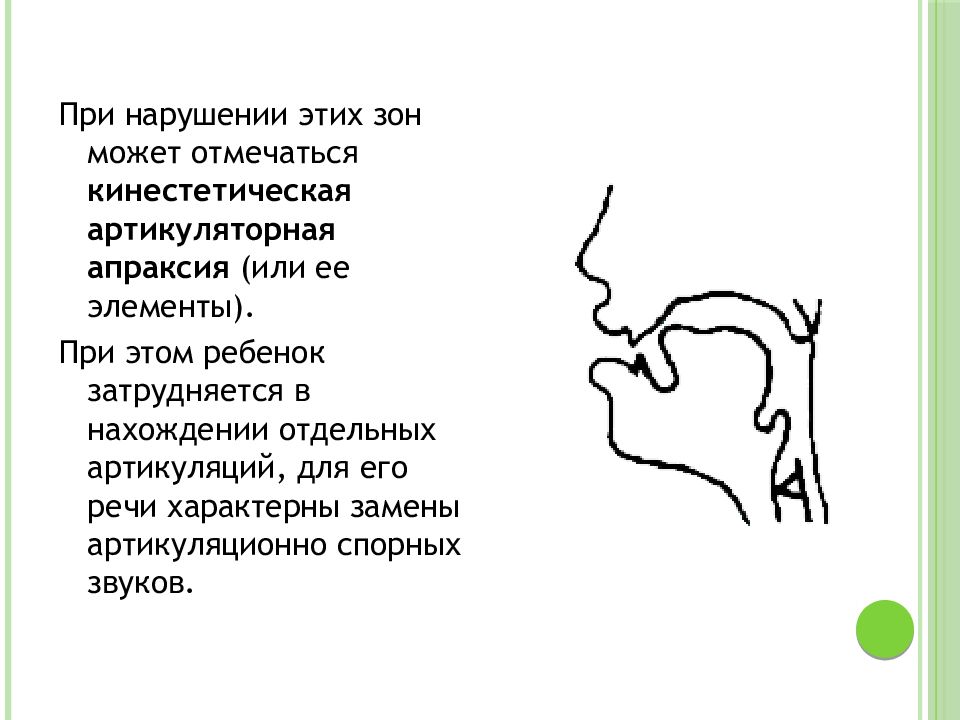 Артикуляционная апраксия презентация